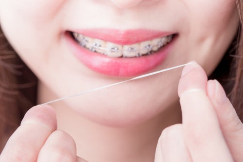 Zahnseide & Zahnspangen: Tipps für ein gesundes Lächeln 