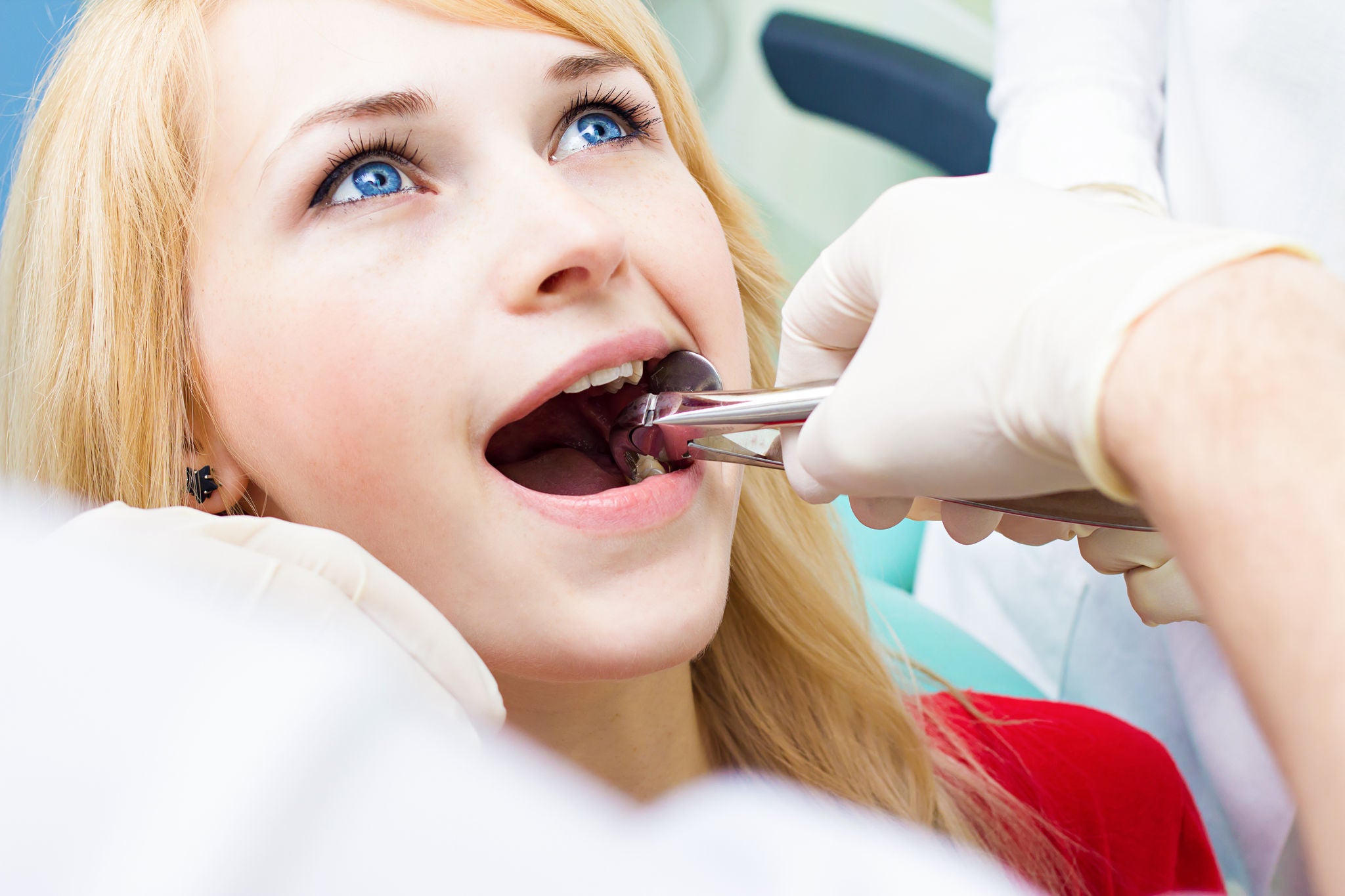 Closeup young woman at dentist clinic office. Male doctor and assistant performing extraction procedure with forceps removing patient tooth. Healthcare dentistry medicine concept 