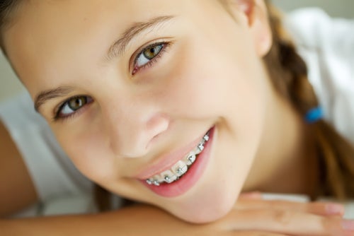 Cire orthodontique : qu'est-ce que c'est, pourquoi l'utiliser et comment l'appliquer ?