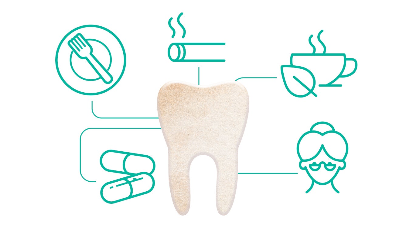 Causes of stained teeth 