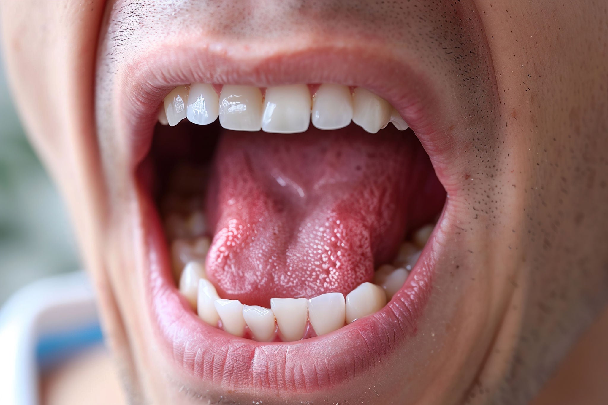 Malattie della lingua: diagnosi e terapie
