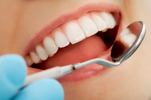 Wybielanie zębów w domu czy u dentysty? Podpowiadamy, co wybrać