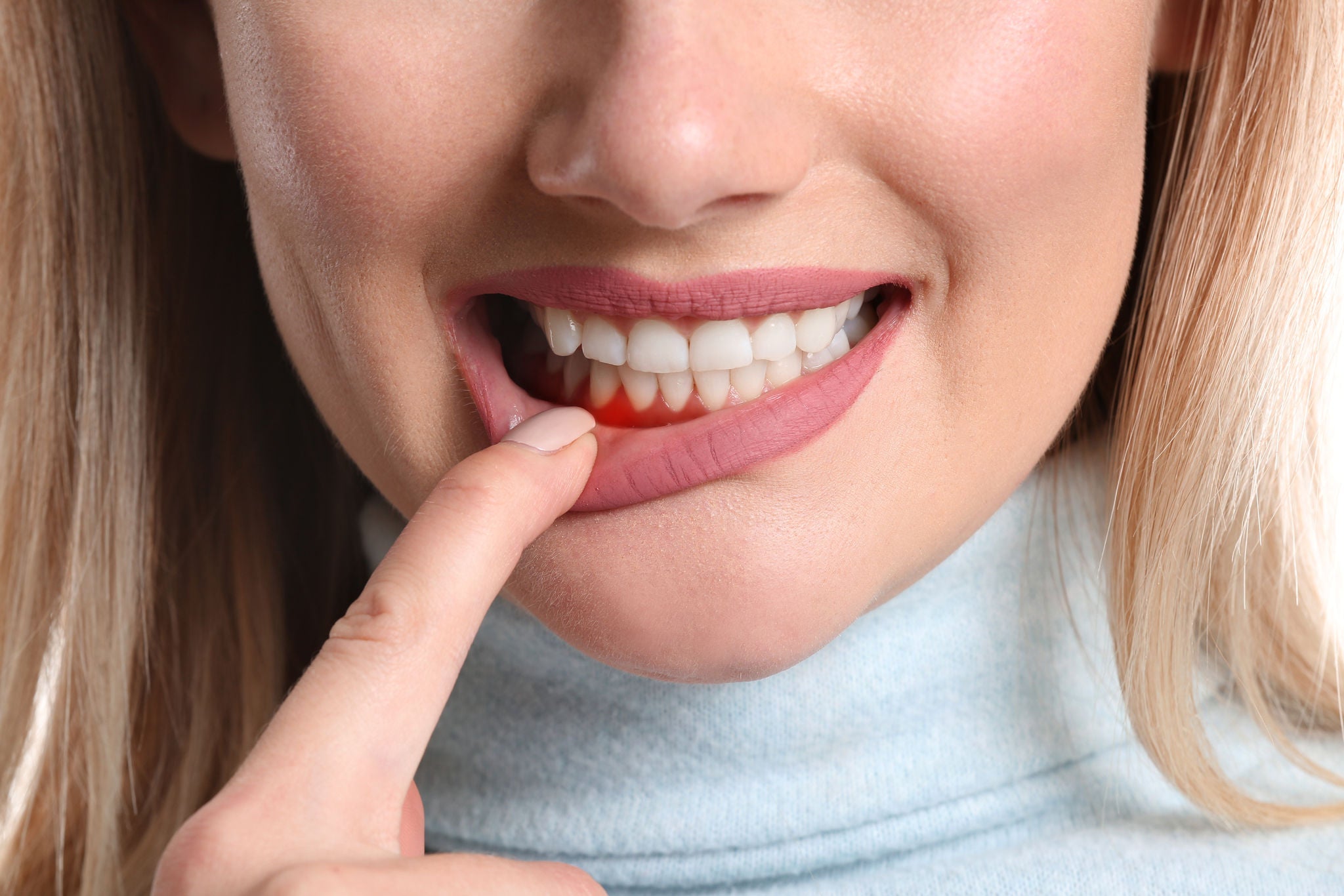 Close-up of a woman with blonde hair, pointing to her swollen gums, indicating potential dental issues. Image resolution: 1920x1280.