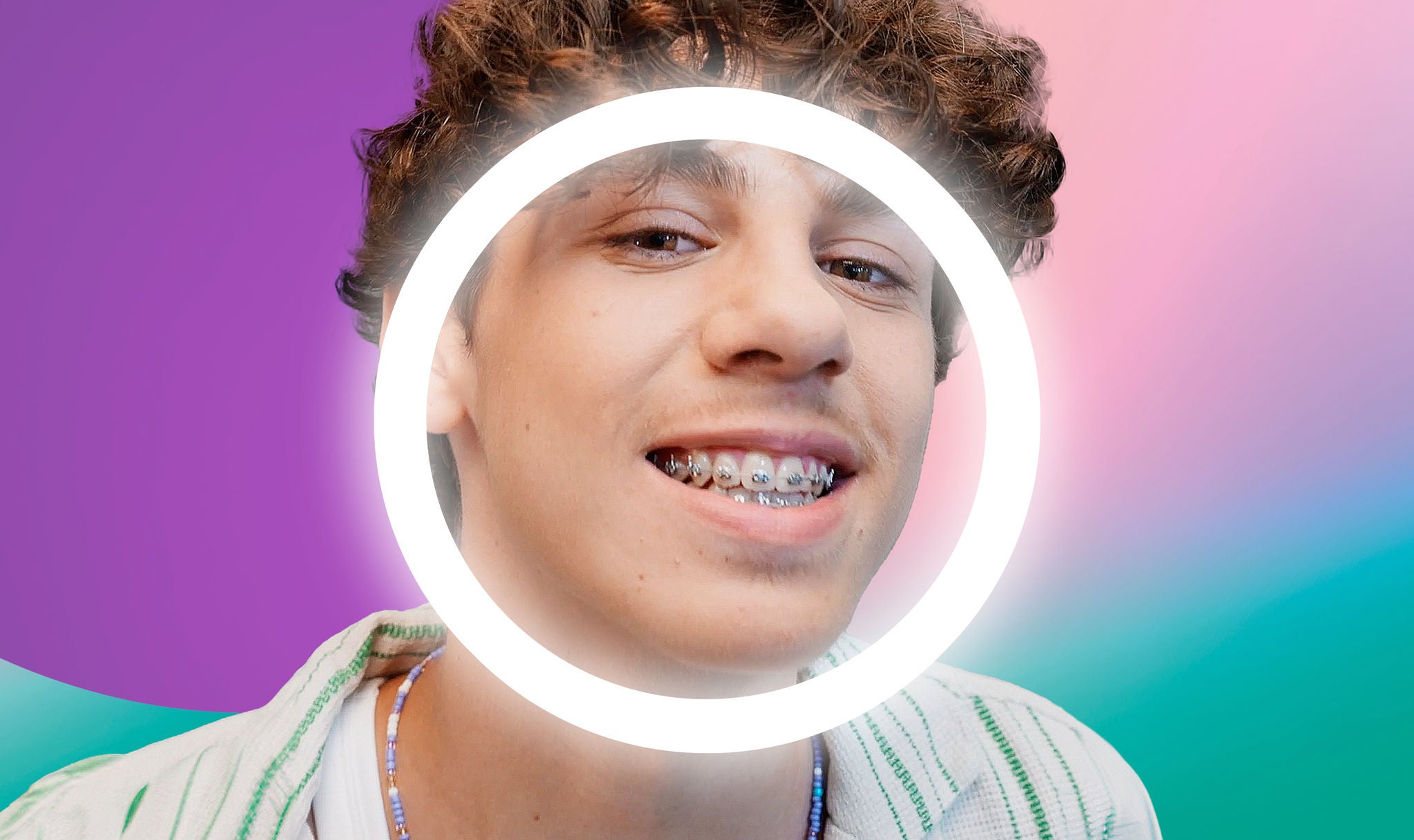 Smiling teenager with a circle around the mouth to better see the braces 