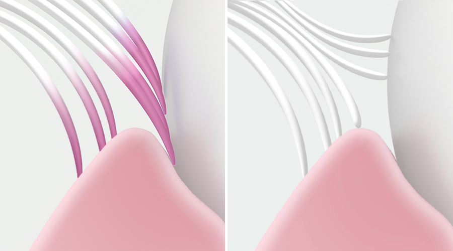 Confronto tra le setole: GUM PRO Sensitive vs. Spazzolino manuale tradizionale