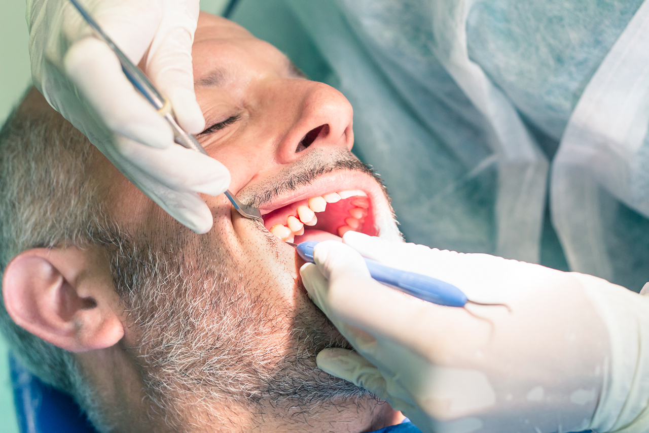 Hvad er tandkødslommer, og hvad kan det føre til?
