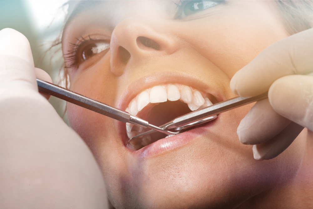 Los riesgos ocultos de la acumulación de placa dental