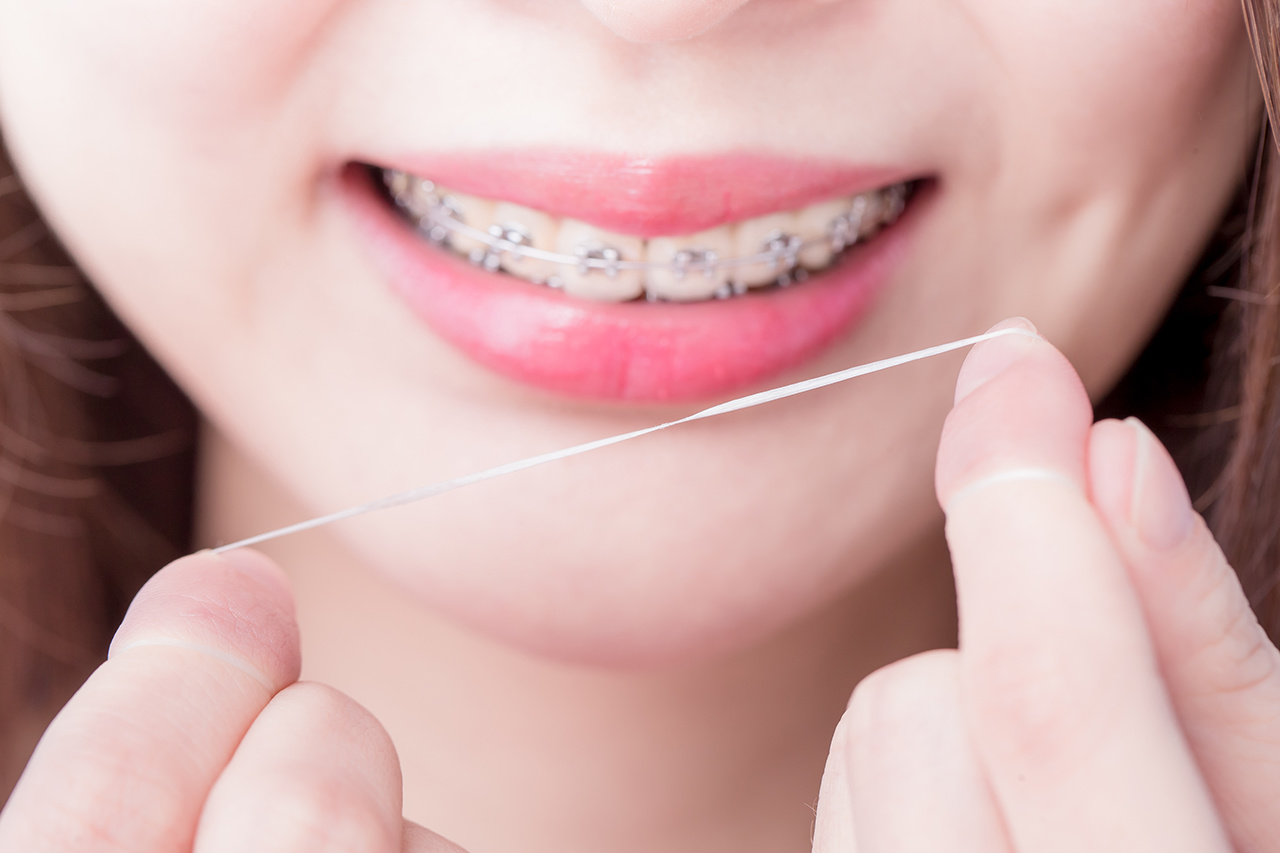 Girl flossing with braces floss strand