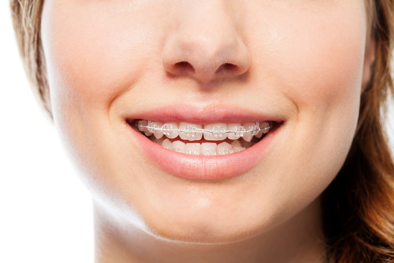 Dentifricio per apparecchio ortodontico [quale scegliere] | GUM®